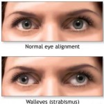 ΣΤΡΑΒΙΣΜΟΣ